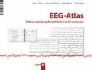 Kniha EEG-Atlas Warren T. Blume