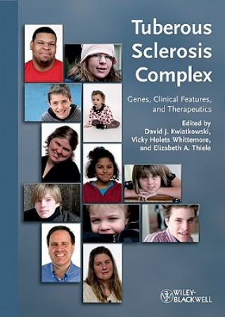 Könyv Tuberous Sclerosis Complex  Genes, Clinical Features and Therapeutics David J. Kwiatkowski
