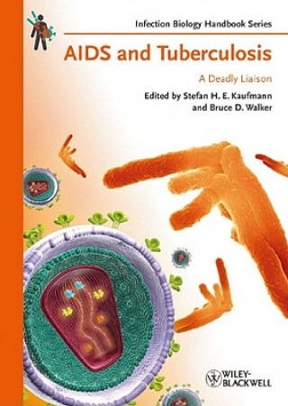 Buch AIDS and Tuberculosis Stefan H. E. Kaufmann