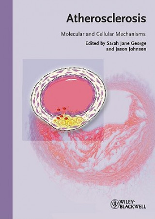 Livre Atherosclerosis Sarah J. George