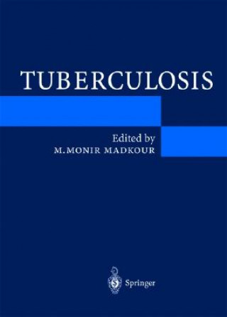 Książka Tuberculosis M. M. Madkour