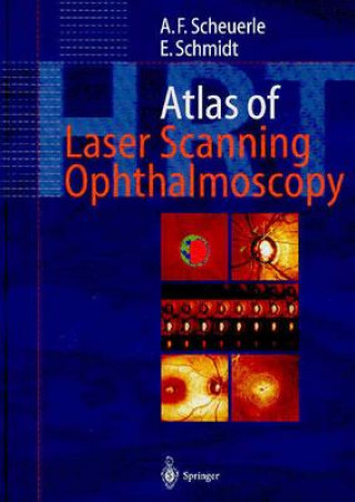 Könyv Atlas of Laser Scanning Ophthalmoscopy A. Scheuerle