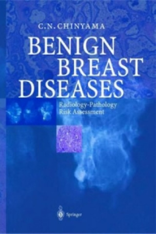 Książka Benign Breast Diseases Catherine N. Chinyama