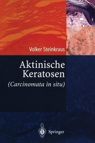 Livre Aktinische Keratosen (Carcinomata in Situ) V. Steinkraus