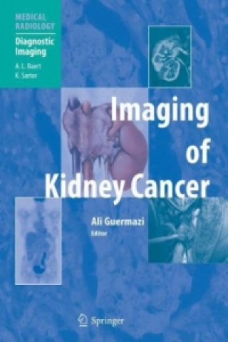 Kniha Imaging of Kidney Cancer Ali Guermazi