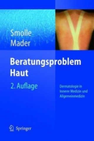 Kniha Beratungsproblem Haut Josef Smolle