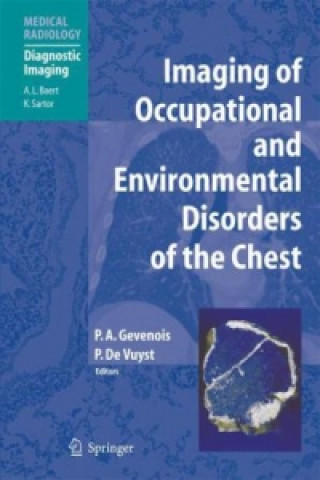 Kniha Imaging of Occupational and Environmental Disorders of the Chest Pierre A. Gevenois