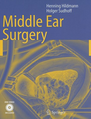 Könyv Middle Ear Surgery Henning Hildmann