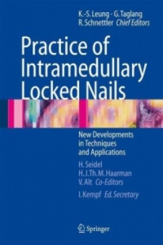 Carte Practice of Intramedullary Locked Nails Kwok-Sui Leung