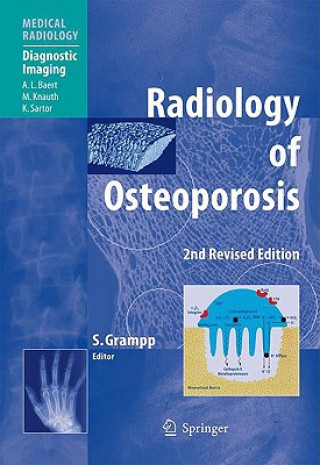 Książka Radiology of Osteoporosis Stephan Grampp