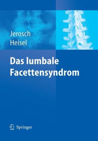 Kniha Das lumbale Facettensyndrom Jörg Jerosch