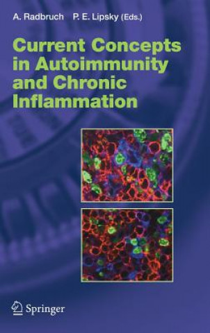 Kniha Current Concepts in Autoimmunity and Chronic Inflammation Andreas Radbruch