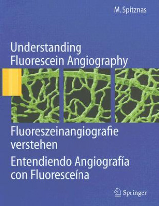 Книга Understanding Fluorescein Angiography Manfred Spitznas