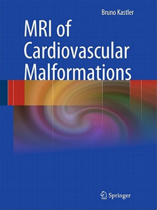 Kniha MRI of Cardiovascular Malformations Bruno Kastler