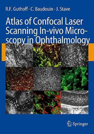 Książka Atlas of Confocal Laser Scanning In-vivo Microscopy in Ophthalmology C. Baudouin