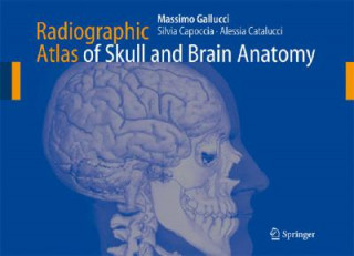 Kniha Radiographic Atlas of Skull and Brain Anatomy Massimo Gallucci