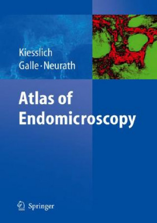Carte Atlas of Endomicroscopy Ralf Kiesslich
