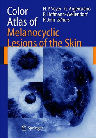 Kniha Color Atlas of Melanocytic Lesions of the Skin Hans P. Soyer