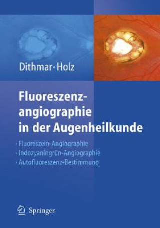 Buch Fluoreszenzangiographie in Der Augenheilkunde Stefan Dithmar