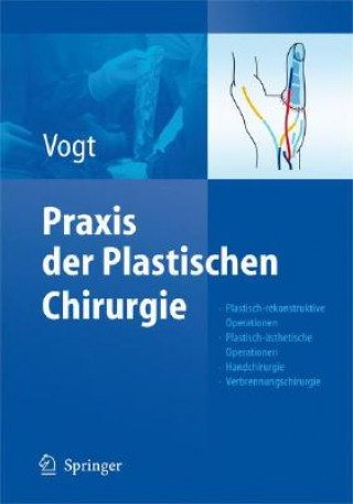 Carte Praxis Der Plastischen Chirurgie Peter M. Vogt