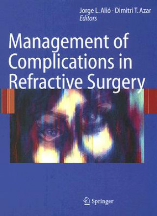 Carte Management of Complications in Refractive Surgery Jorge L. Alió y Sanz
