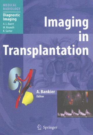 Kniha Imaging in Transplantation Alexander A. Bankier