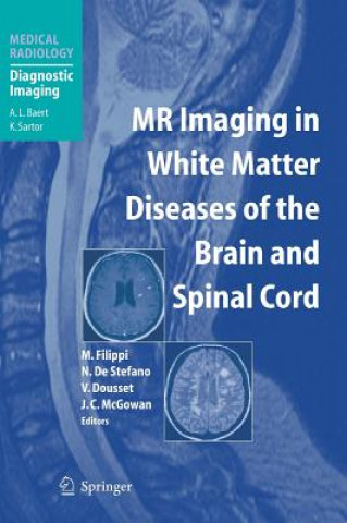 Könyv MR Imaging in White Matter Diseases of the Brain and Spinal Cord Massimo Filippi