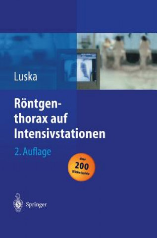 Kniha Roentgenthorax auf Intensivstationen Günter Luska