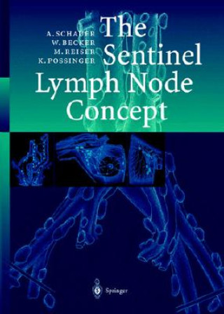 Kniha The Sentinel Lymph Node Concept Alfred J. Schauer