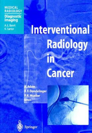 Kniha Interventional Radiology in Cancer Andreas Adam