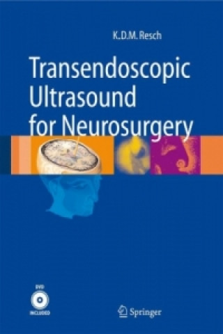 Kniha Transendoscopic Ultrasound for Neurosurgery, w. DVD Klaus D. M. Resch