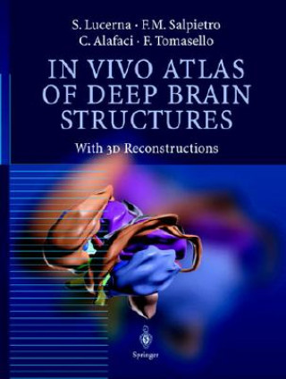 Carte In Vivo Atlas of Deep Brain Structures Sebastiano Lucerna