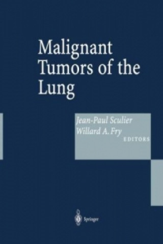 Książka Malignant Tumors of the Lung Jean-Paul Sculier