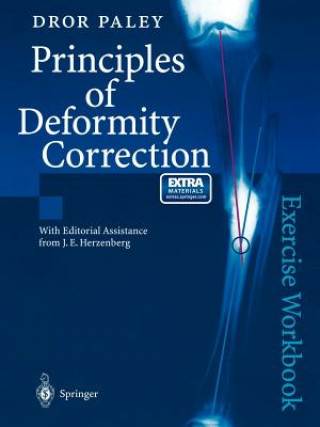 Kniha Principles of Deformity Correction Dror Paley