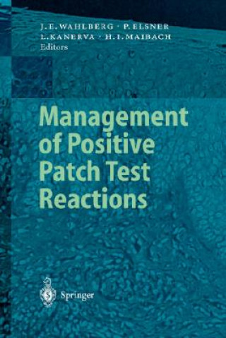 Книга Management of Positive Patch Test Reactions Jan E. Wahlberg