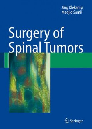 Carte Surgery of Spinal Tumors Jörg Klekamp