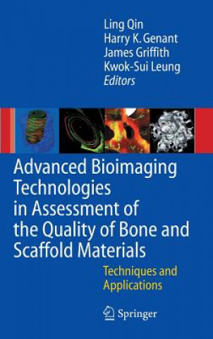 Könyv Advanced Bioimaging Technologies in Assessment of the Quality of Bone and Scaffold Materials ing Qin