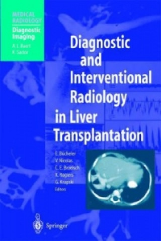 Carte Diagnostic and Interventional Radiology in Liver Transplantation Egon Bücheler