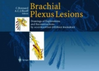 Kniha Brachial Plexus Lesions Chantal Bonnard