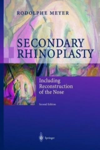 Könyv Secondary Rhinoplasty Rodolphe Meyer