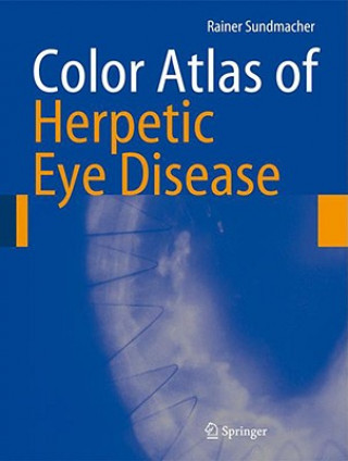 Livre Color Atlas of Herpetic Eye Disease Rainer Sundmacher