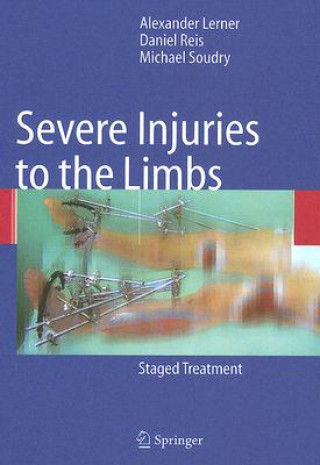 Book Severe Injuries to the Limbs Alexander Lerner