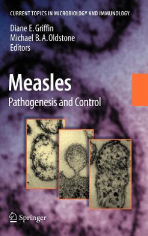 Carte Measles Diane E. Griffin