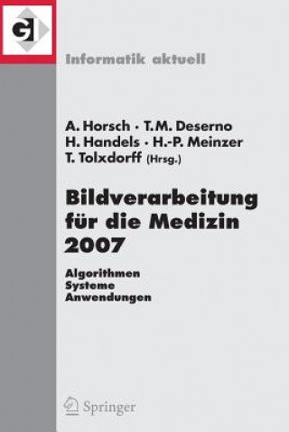 Knjiga Bildverarbeitung fur Die Medizin Alexander Horsch