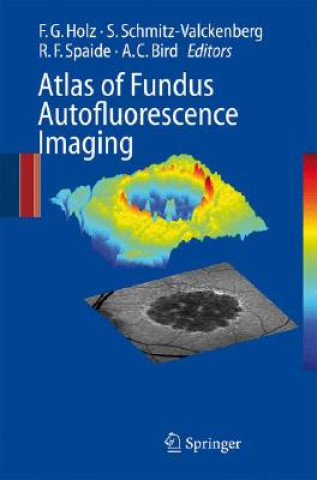 Könyv Atlas of Fundus Autofluorescence Imaging Frank G. Holz