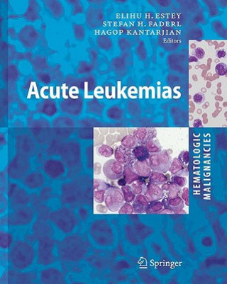 Könyv Hematologic Malignancies: Acute Leukemias Elihu H. Estey