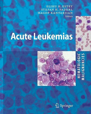 Book Hematologic Malignancies: Acute Leukemias Elihu H. Estey