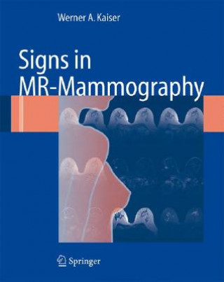 Książka Signs in MR-Mammography Werner A. Kaiser