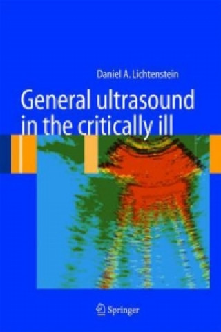 Carte General ultrasound in the critically ill D. A. Lichtenstein