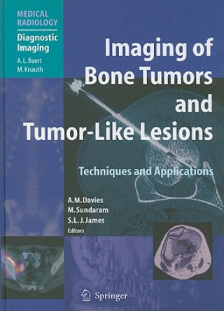 Livro Imaging of Bone Tumors and Tumor-Like Lesions A. Mark Davies
